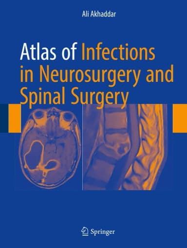Image of - Atlas of Infections in Neurosurgery and Spinal Surgery | Hardcover