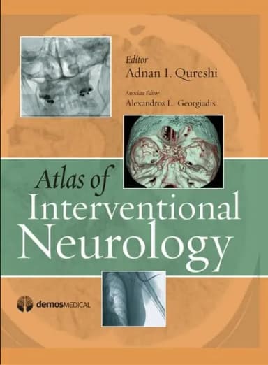 Image of - Atlas of Interventional Neurology | Hardcover