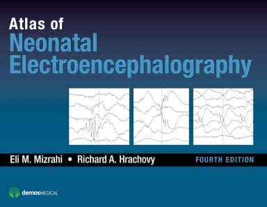 Image of - Atlas of Neonatal Electroencephalography | 4th Edition | Hardcover