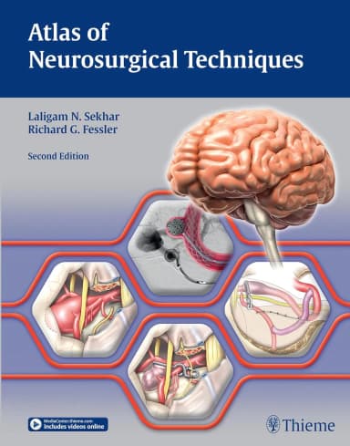 Image of - Atlas of Neurosurgical Techniques | 2nd Edition | Hardcover