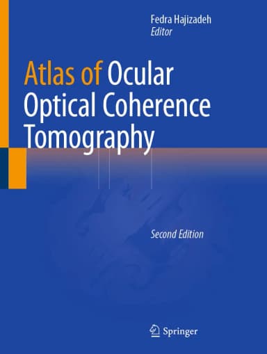 Image of - Atlas Of Ocular Optical Coherence Tomography 2nd Edition | Hardcover