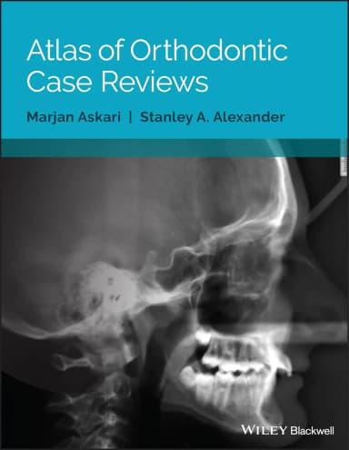 Image of - Atlas of Orthodontic Case Reviews | Paperback