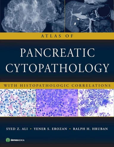 Image of - Atlas of Pancreatic Cytopathology With Histopathologic Correlations | Hardcover