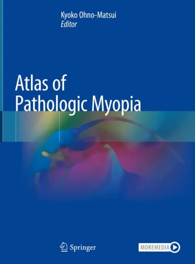 Image of - Atlas Of Pathologic Myopia | Hardcover