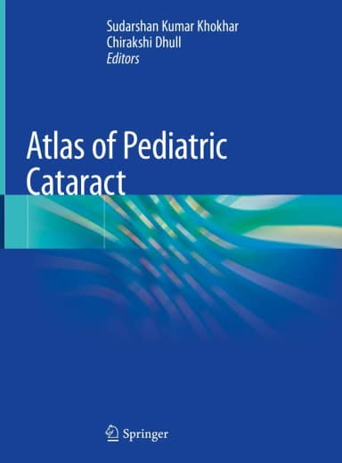 Image of - Atlas of Pediatric Cataract | Hardcover