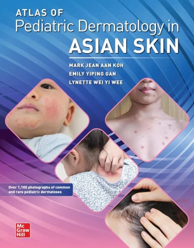 Image of - Atlas Of Pediatric Dermatology In Asian Skin | Paperback