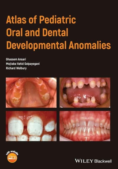Image of - Atlas of Pediatric Oral and Dental Developmental Anomalies | Paperback