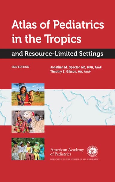 Image of - Atlas of Pediatrics in the Tropics and Resource-Limited Settings | 2nd Edition | Hardcover