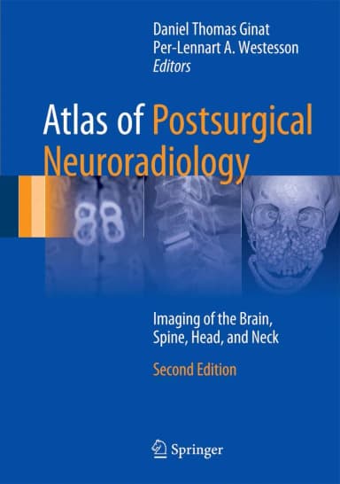 Image of - Atlas of Postsurgical Neuroradiology | 2nd Edition | Hardcover