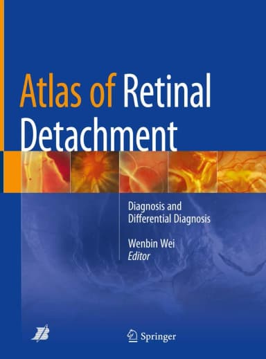Image of - Atlas of Retinal Detachment | Hardcover