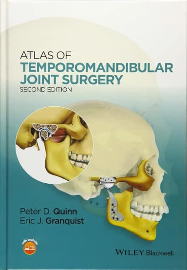 Image of - Atlas of Temporomandibular Joint Surgery | 2nd Edition | Hardcover