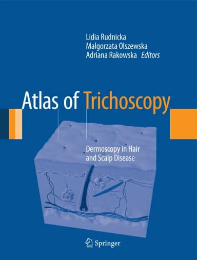 Image of - Atlas of Trichoscopy Dermoscopy in Hair and Scalp Disease | Hardcover