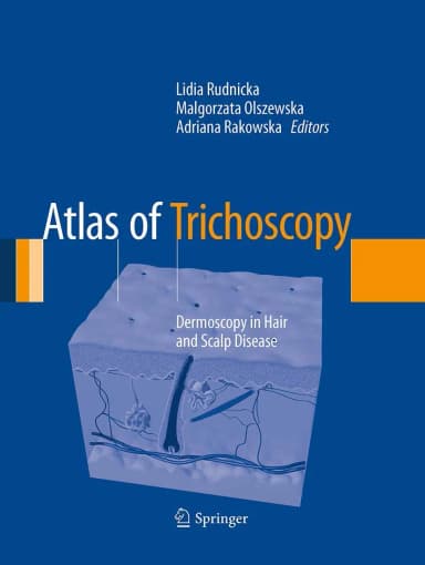 Image of - Atlas of Trichoscopy Dermoscopy Hair and Scalp Disease | Paperback