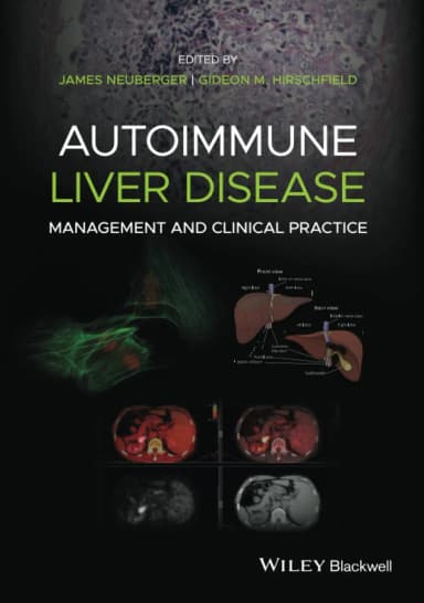 Image of - Autoimmune Liver Disease Management And Clinical Practice | Hardcover