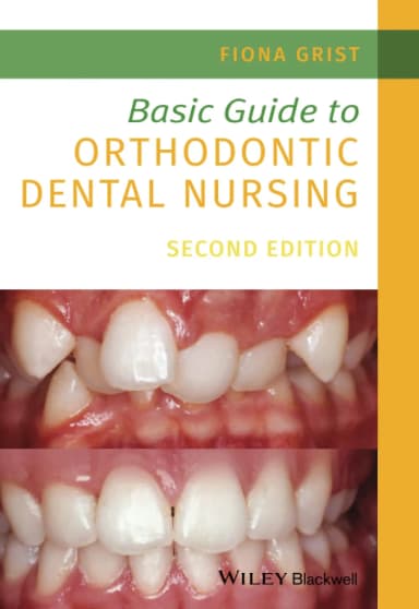 Image of - Basic Guide To Orthodontic Dental Nursing 2nd Edition | Paperback