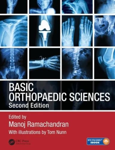 Image of - Basic Orthopaedic Sciences | 2nd Edition | Hardcover