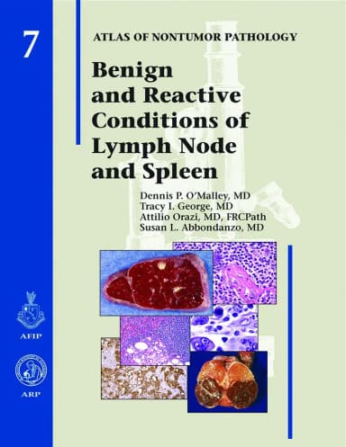 Image of - Benign and Reactive Conditions of Lymph Node and Spleen | Series 7 | Hardcover