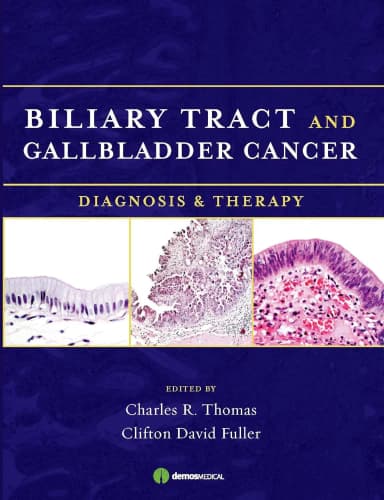 Image of - Billiary Tract and Gallbladder Cancer | Hardcover