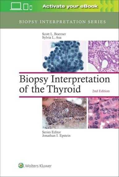 Image of - Biopsy Interpretaition of the Thyroid | 2nd Edition | Hardcover
