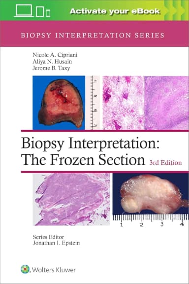 Image of - Biopsy Interpretation The Frozen Section Third Edition | Hardcover