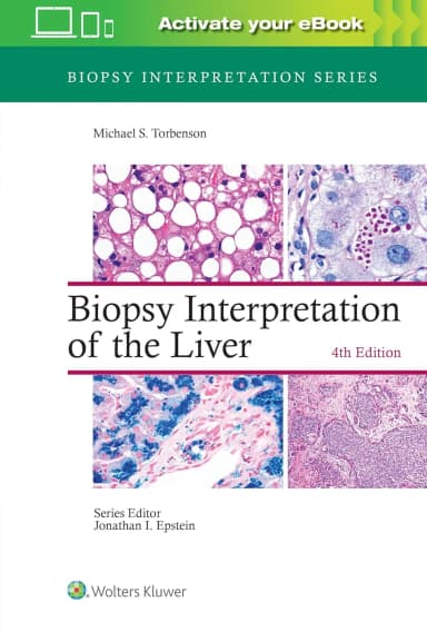 Image of - Biopsy Interpretation of the Liver With Access Code | 4th Edition | Hardcover