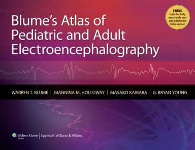 Image of - Blume's Atlas of Pediatric and Adult Electroencephalography | Hardcover
