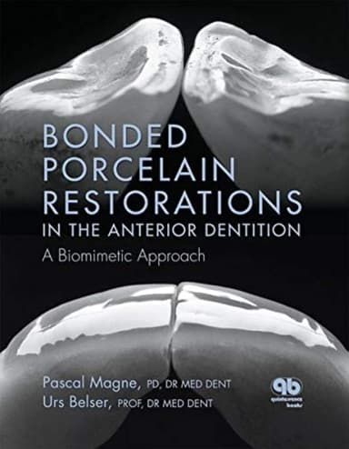 Image of - Bonded Porcelain Restorations in the Anterior Dentition | Hardcover