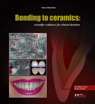 Image of - Bonding to Ceramics Scientific Evidences for Clinical Dentistry | Hardcover