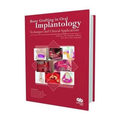 Image of - Bone Grafting in Oral Implantology Techniques and Clinical Applications | Hardcover