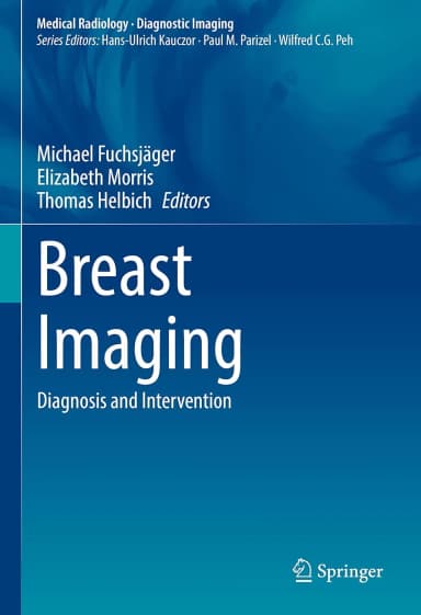 Image of - Breast Imaging Diagnosis And Intervention | Hardcover