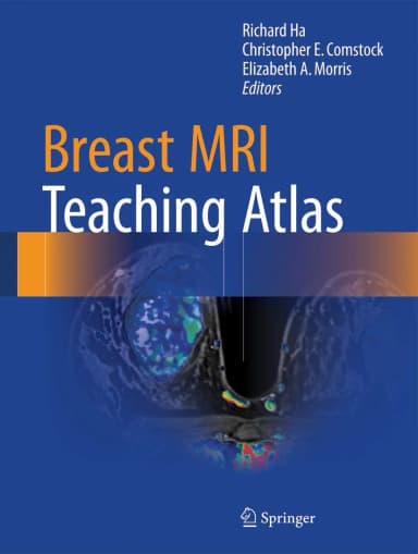Image of - Breast MRI Teaching Atlas | Hardcover