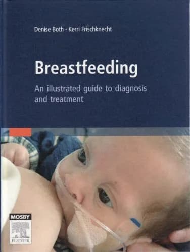 Image of - Breastfeeding An Illustrated Guide to Diagnosis and Treatment | Hardcover