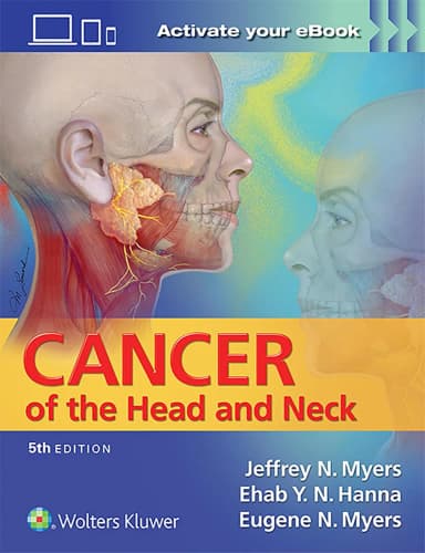 Image of - Cancer of the Head and Neck | 5th Edition | Hardcover