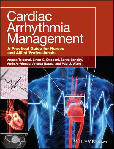 Image of - Cardiac Arrhythmia Management | Paperback