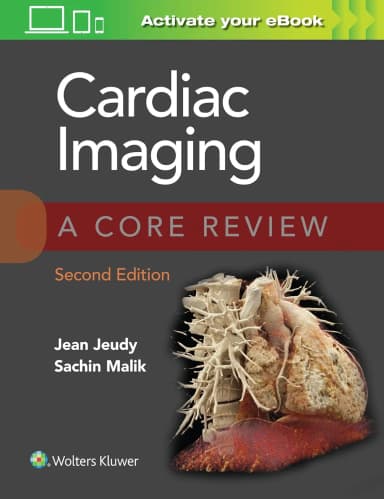 Image of - Cardiac Imaging A Core Review | 2nd Edition With Access Code | Paperback