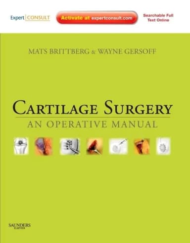 Image of - Cartilage Surgery An Operative Manual | Hardcover