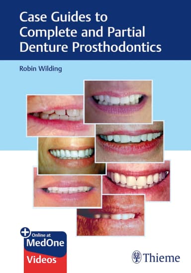 Image of - Case Guides to Complete and Partial Denture Prosthodontics | Paperback