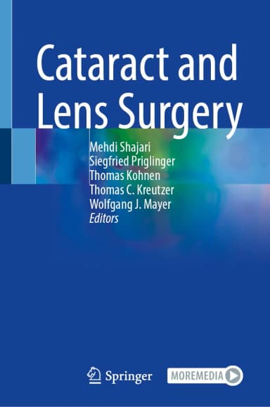 Image of - Cataract And Lens Surgery | Hardcover