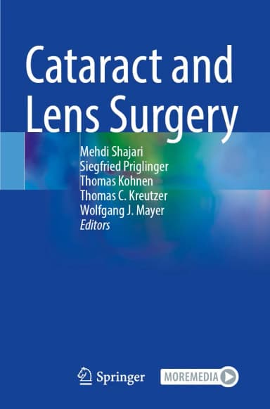 Image of - Cataract And Lens Surgery | Paperback
