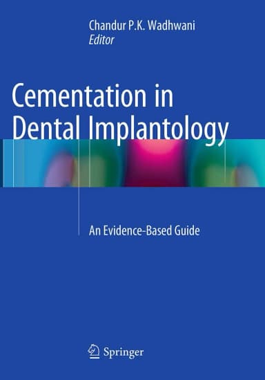 Image of - Cementation In Dental Implantology An Evidence Based Guide | Paperback
