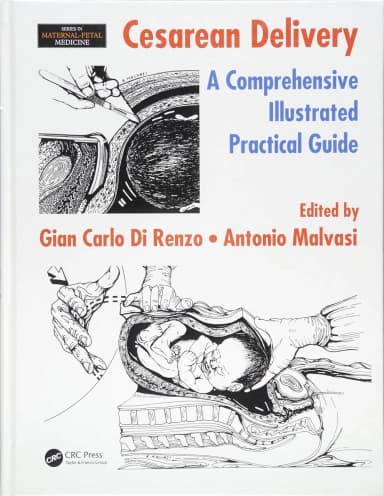 Image of - Cesarean Delivery A Comprehensive Illustrated Practical Guide | Hardcover