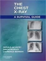 Image of - The Chest X-Ray A Survival Guide | Paperback