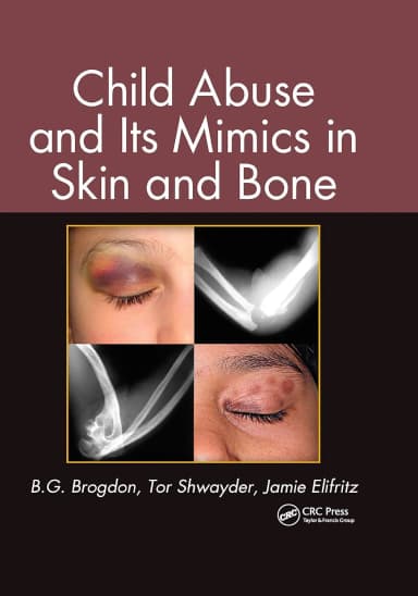 Image of - Child Abuse and Its Mimics in Skin and Bone | Hardcover