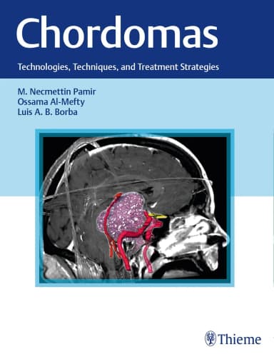 Image of - Chordomas Technologies | Techniques | and Treatment Strategies | Hardcover