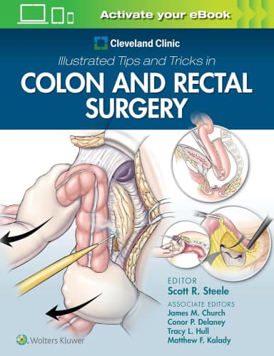 Image of - Cleveland Clinic Illustrated Tips And Tricks In Colon And Rectal Surgery | Paperback