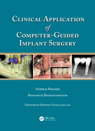 Image of - Clinical Application of Computer Guided Implant Surgery | Hardcover