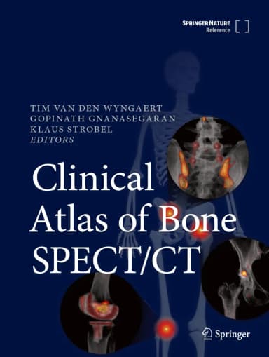Image of - Clinical Atlas Of Bone Spect Ct 2 Vol Set | Hardcover