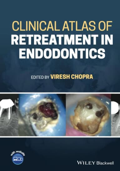 Image of - Clinical Atlas Of Retreatment In Endodontics | Hardcover