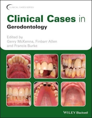 Image of - Clinical Cases In Gerodontology | Paperback
