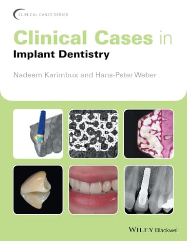 Image of - Clinical Cases in Implant Dentistry | Paperback